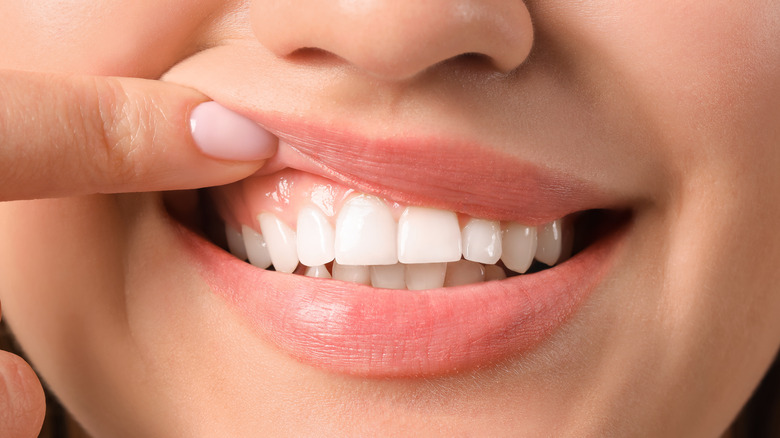 Účinky kolagenu na zuby a dásně