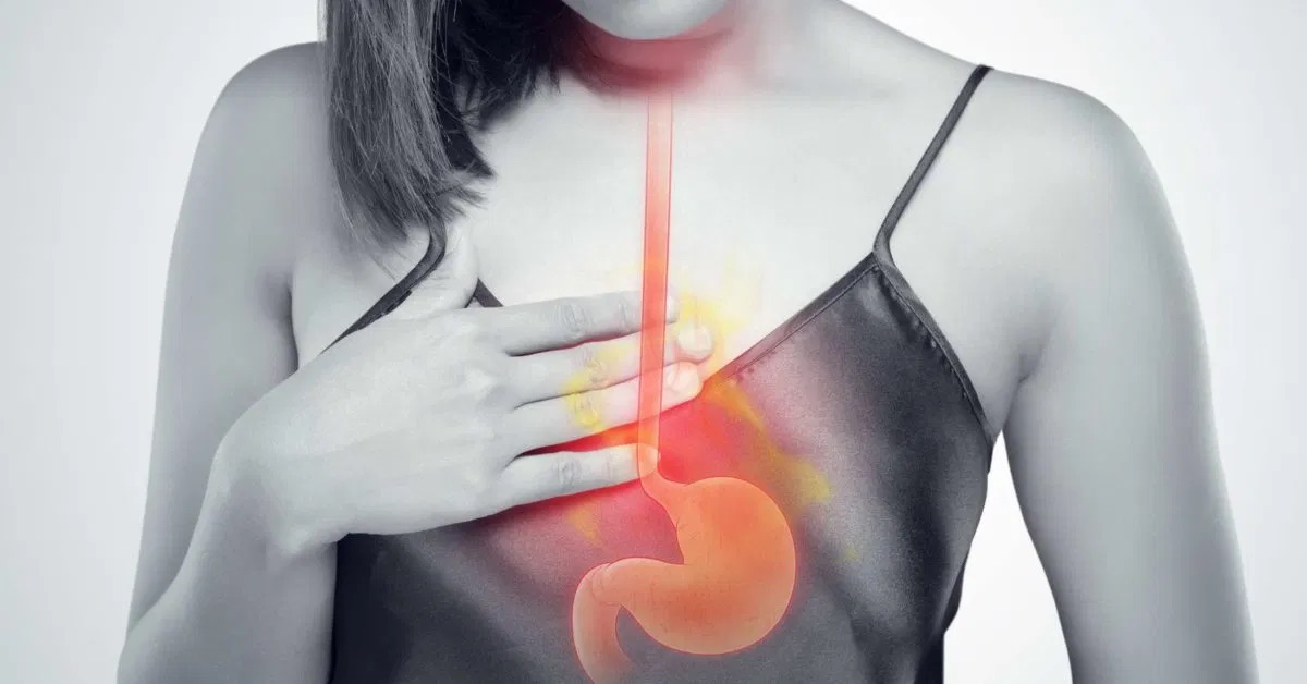 Kyselý reflux: příčiny a léčba