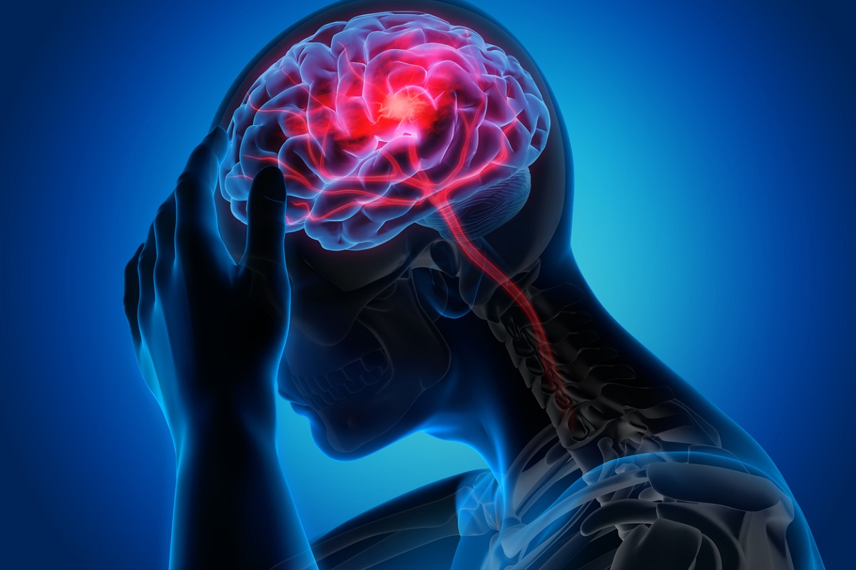 Neurologické poruchy