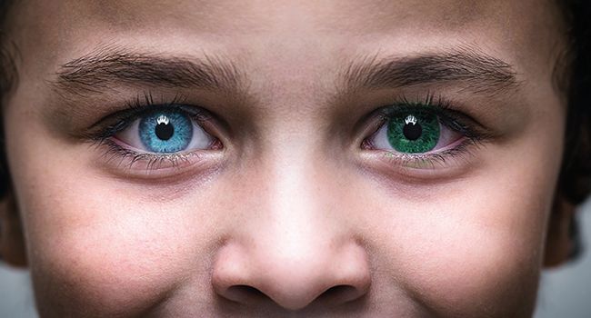 Heterochromie očí