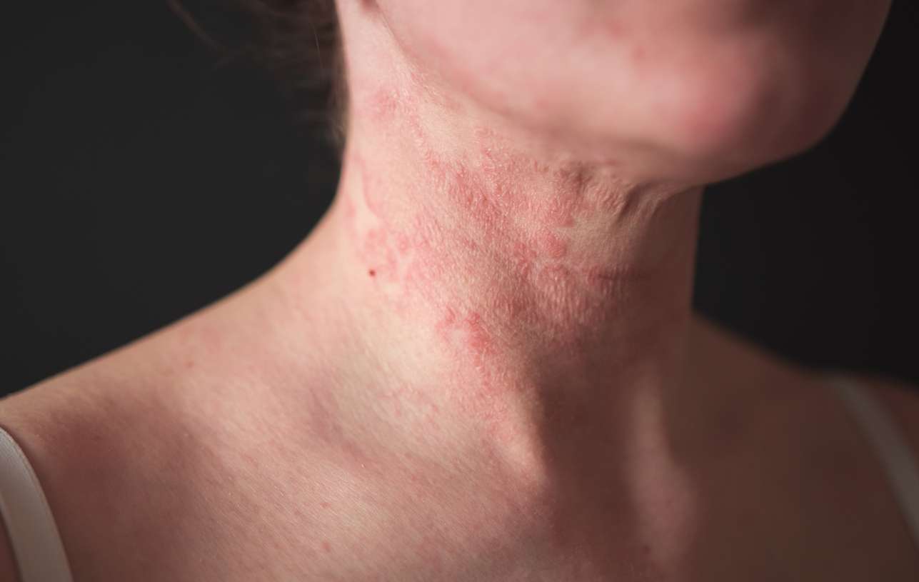 probiotika_2