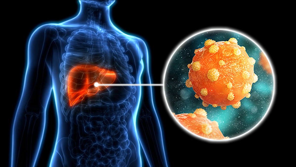 Hepatitída B