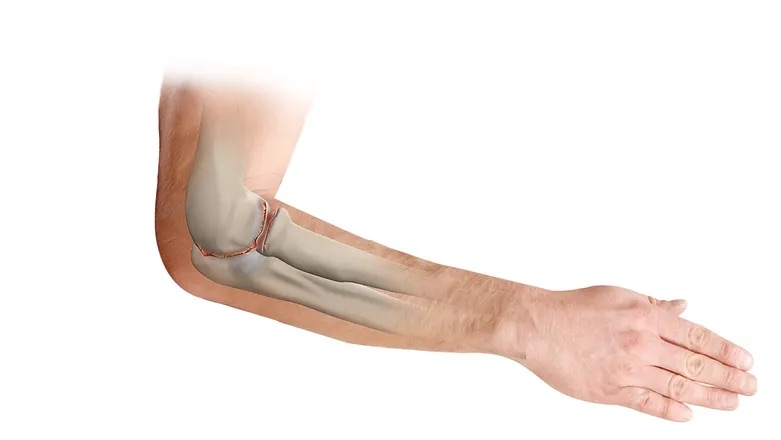 Lakťový kĺb