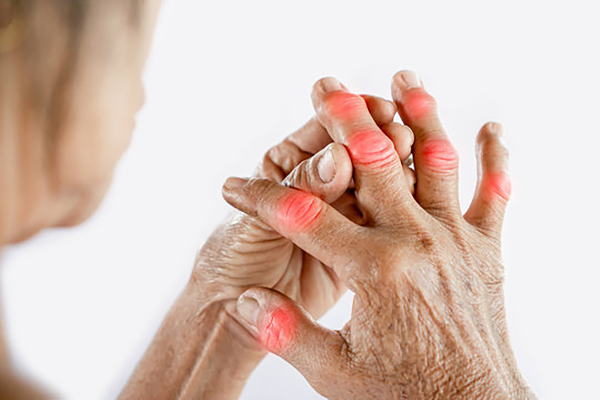 4 štádiá a progresia reumatoidnej artritídy