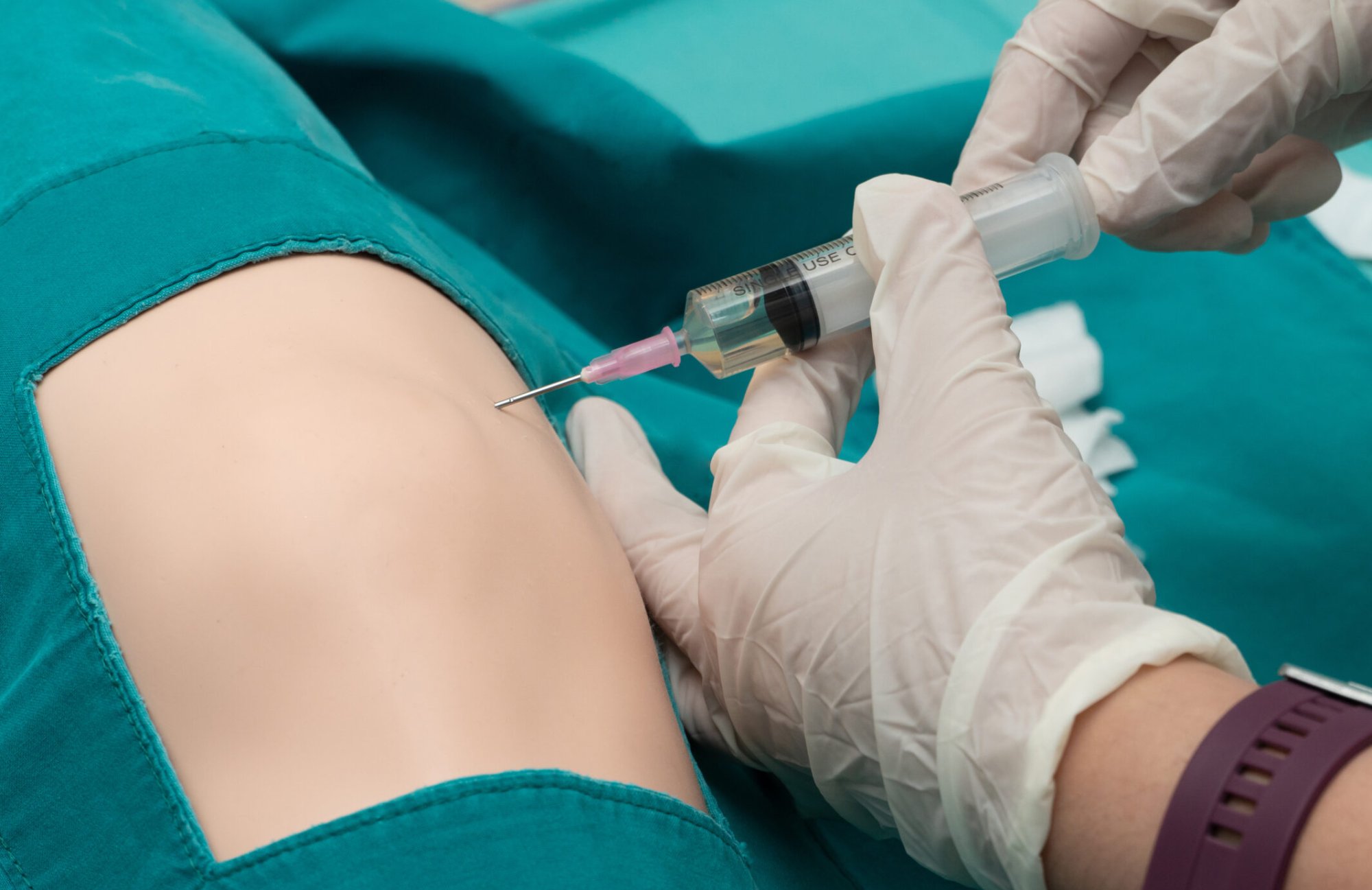 Artrocentéza (aspirácia kĺbov)