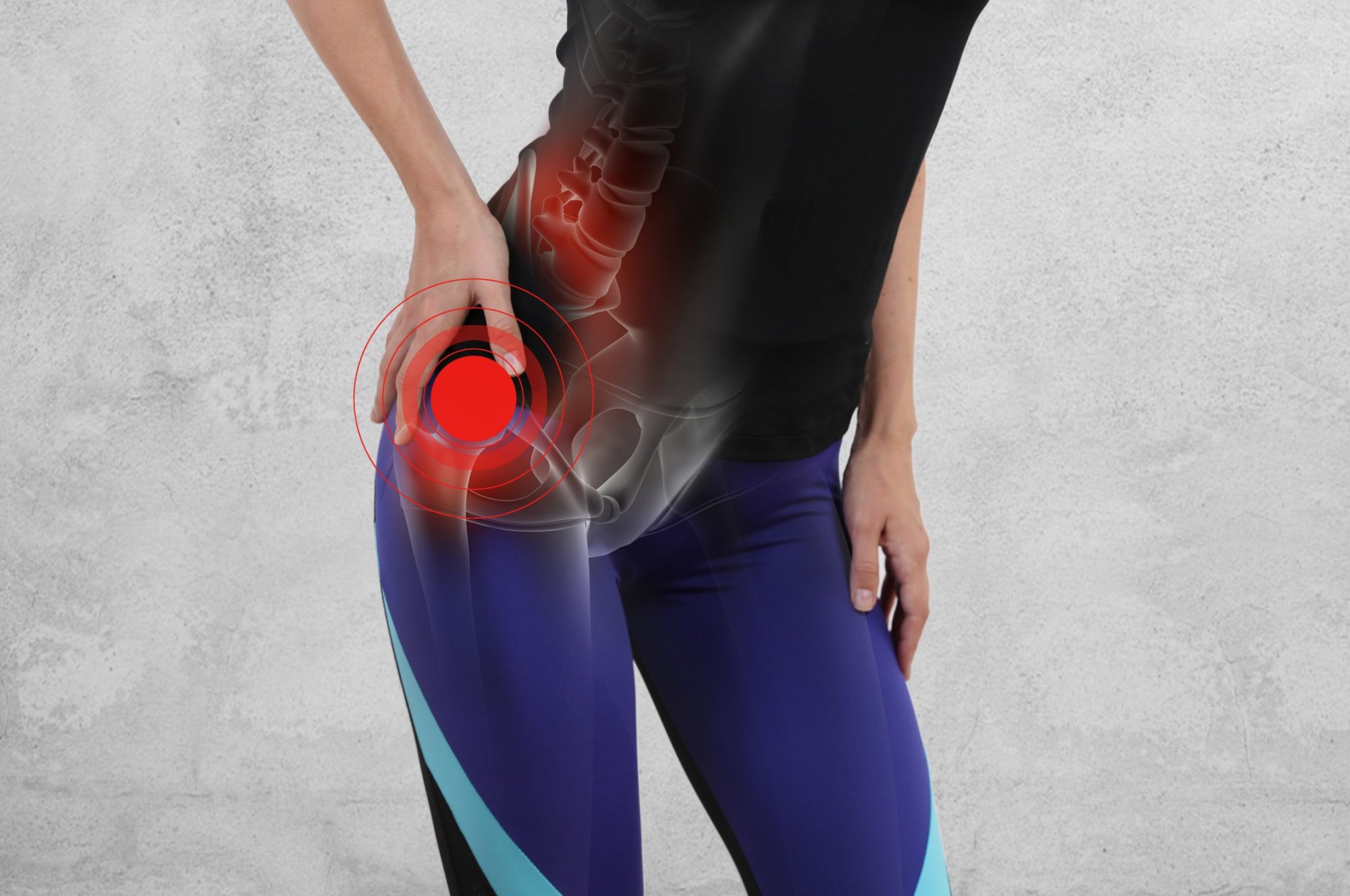 Bolesť bedrového kĺbu pri chôdzi