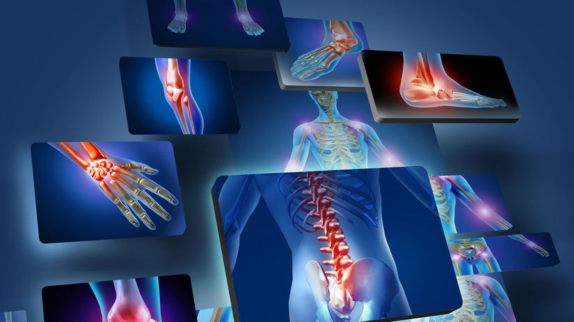 7 najčastejších príčin bolesti kĺbov a ako im predchádzať