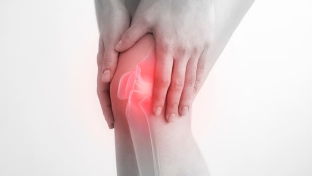 Hemartróza (krvácanie z kĺbov)