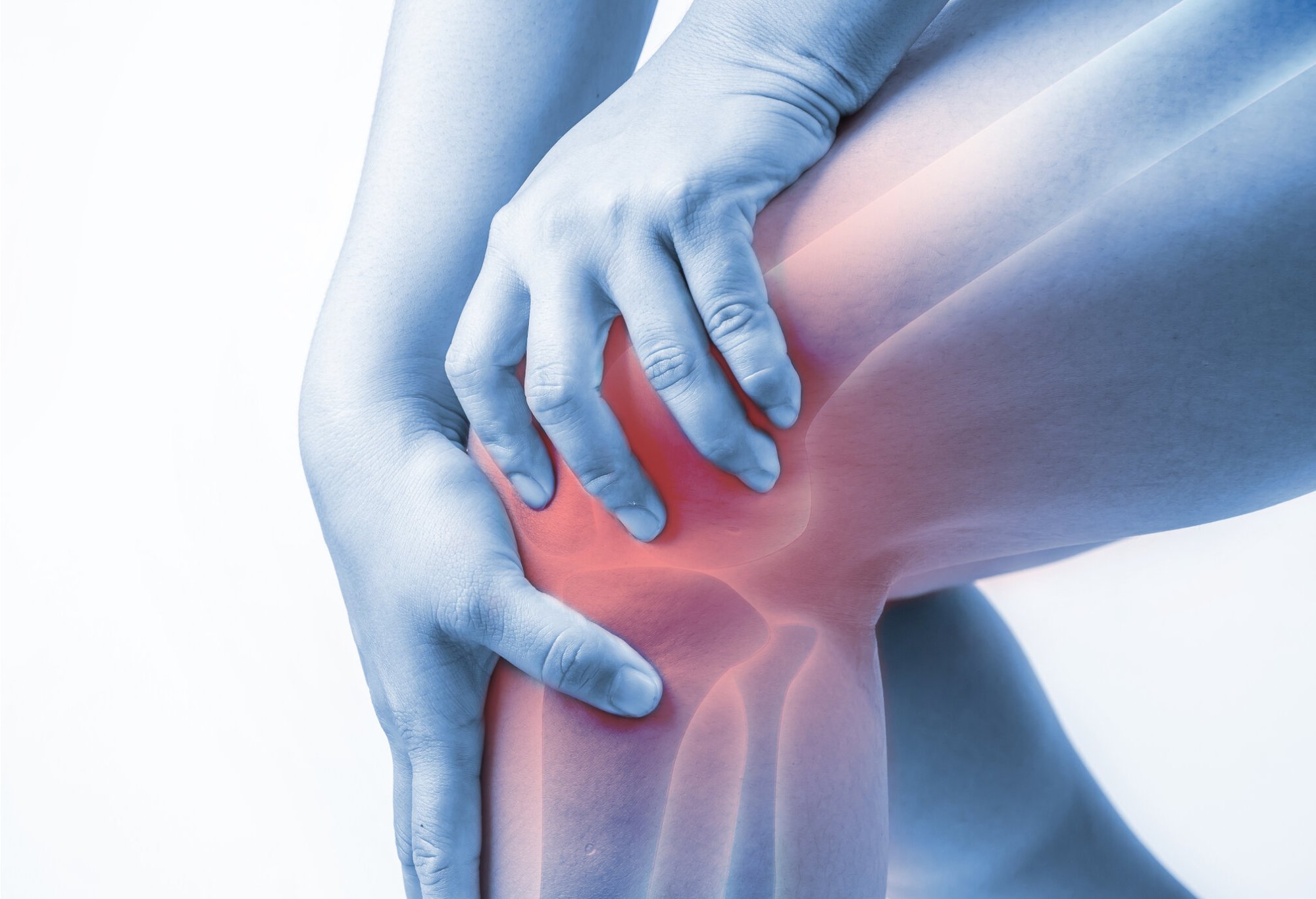 Môžu kolagénové doplnky pomôcť pri artritíde?