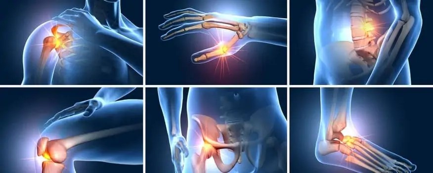 Popôrodná bolesť kĺbov