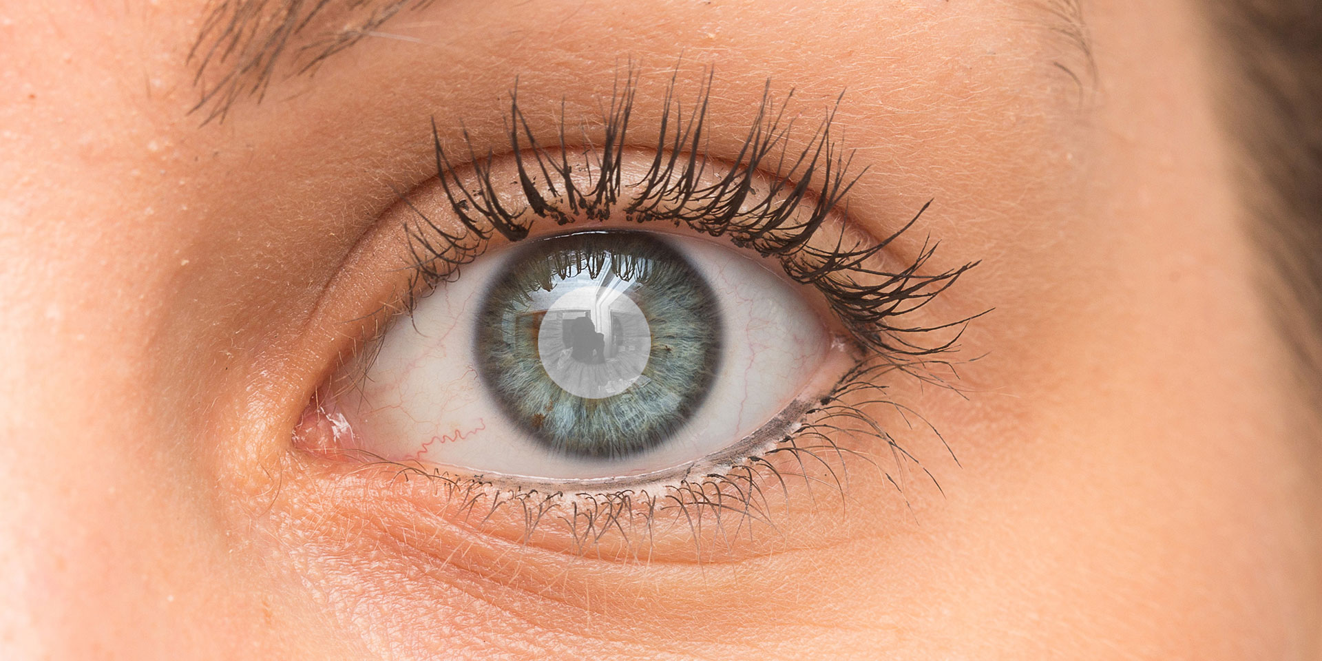 Šedý zákal: Podrobný pohľad na jednu z najčastejších príčin slepoty