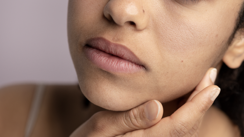 Čo spôsobuje suchú pokožku a ako ju liečiť