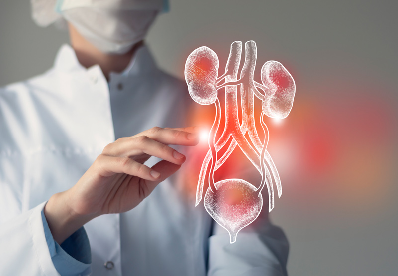 Cystitída (zápal močového mechúra)