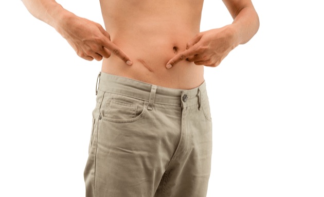 Zápal slepého čreva