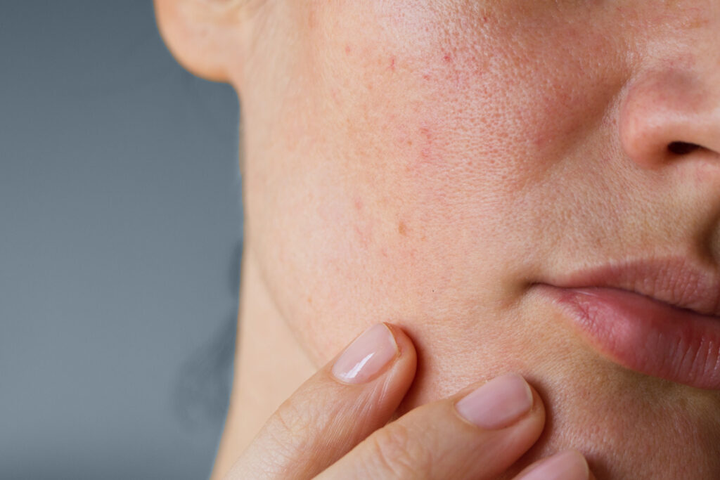 Co probiotyki mają wspólnego ze skórą?