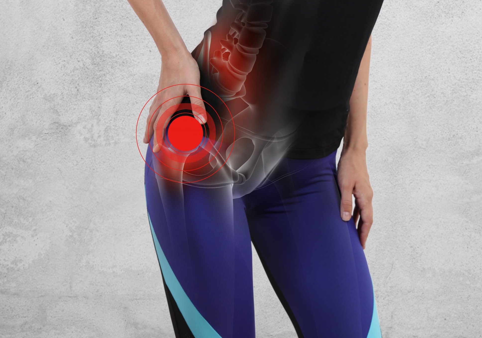 Ból biodra podczas chodzenia