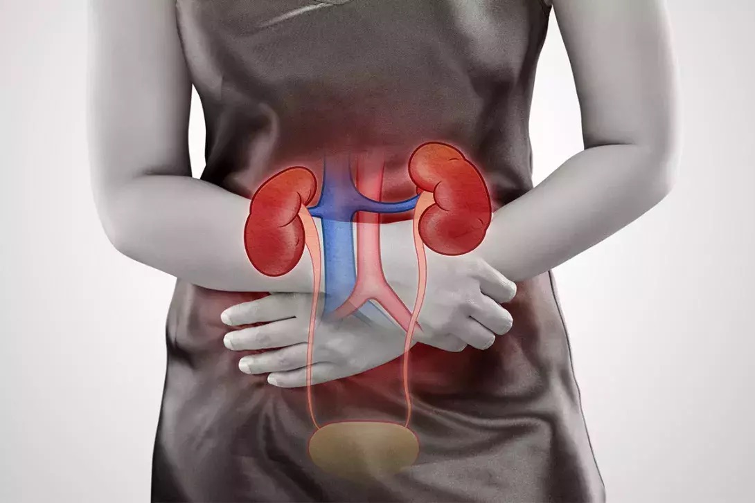 Przewlekłe infekcje dróg moczowych