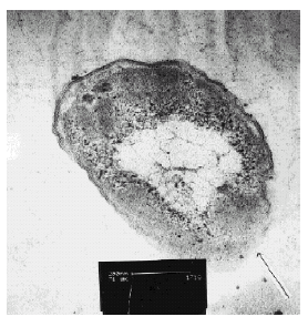 bunecna-stena-E-Coli-narusena-stribrem