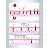 epilator ipl premium br 1400 210447451164613