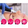 ultrazvukova spachtle peel lift premium br 1540 213836452165302