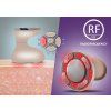 esteticky pristroj beautyrelax celluform optimal 231182737112715