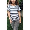 Prúžky oversize tričko so zipsami na dojčenie