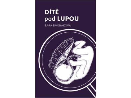 big dite pod lupou