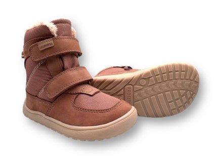 protetika lora odl pink zimne barefoot topanky3