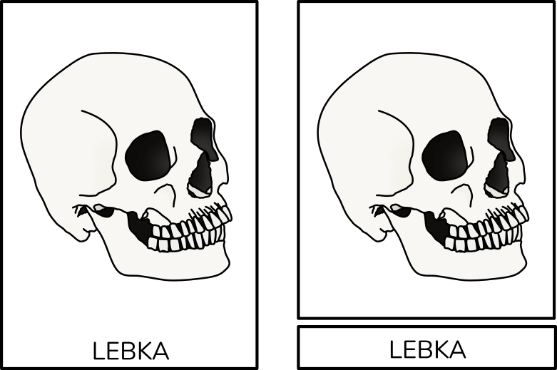 trislozkove-kart-lebka