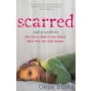 Scarred [Andrews, Sophie]