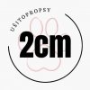 2cm