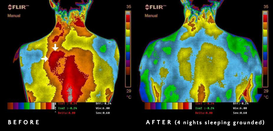 thermography1_2