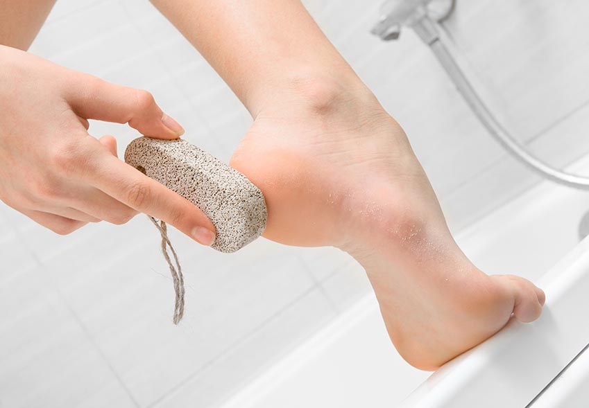 Ako správne odstrániť mozole na nohách?