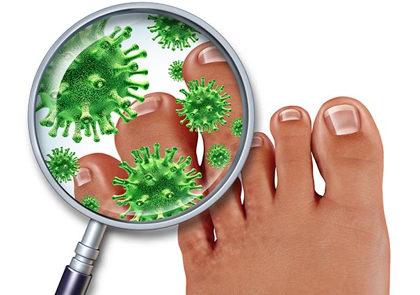 Ako liečiť pleseň na nechtoch? Čo skutočne funguje?