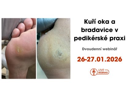 YouTube banner webinar