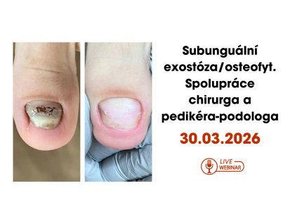 YouTube banner webinar