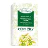 cevy zily 300x300