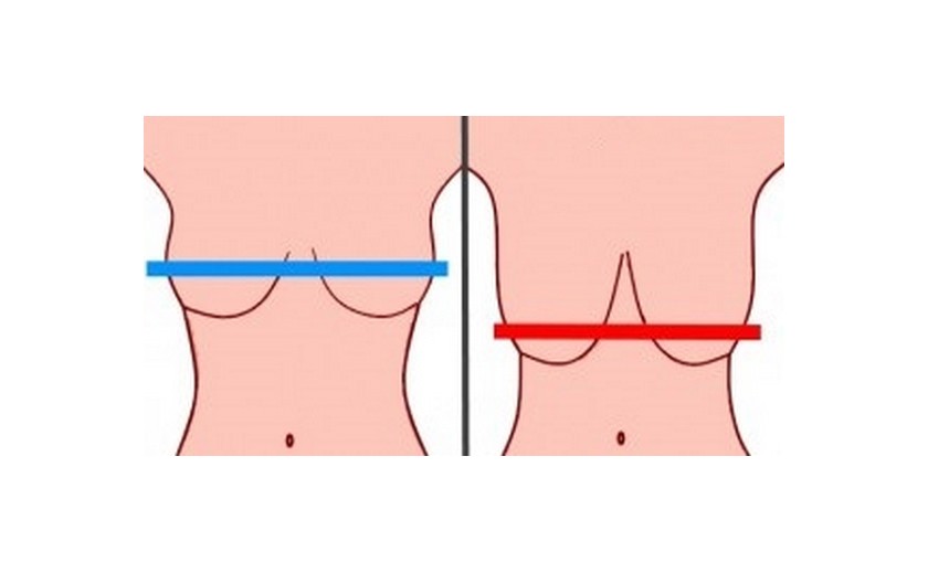 Tyto každodenní zlozvyky neodvratně způsobují povislá prsa