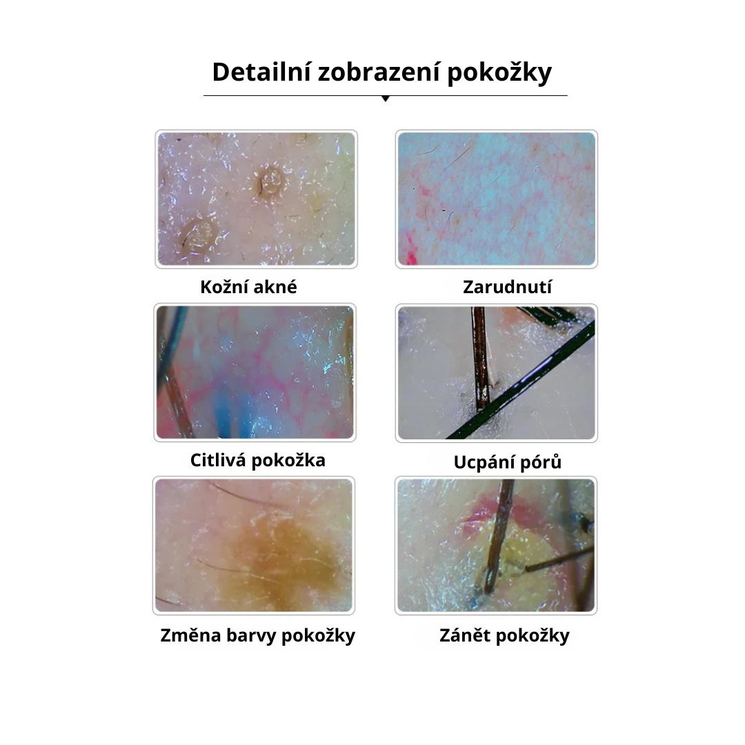 Profesionální analyzér vlasů a pokožky - Headspa (obrázek 5)