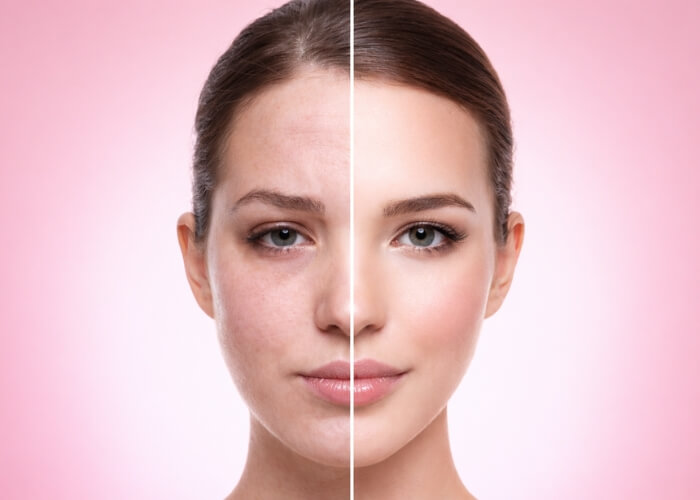 Cortisol face: Může za oteklý obličej opravdu stres? A funguje face yoga?