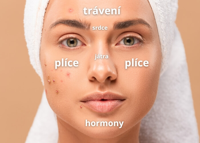 Mapování pleti: Co ti říkají pupínky podle toho, kde se tvoří?