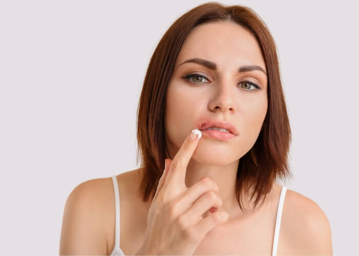 Opary a afty - příčiny, příznaky a jak se jich zbavit