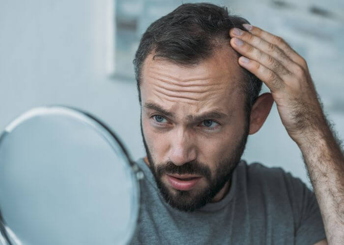 Vypadávání vlasů u mužů: Jak s tím zatočit?