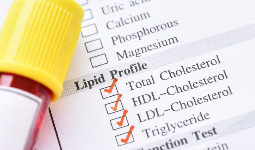 Krevní testy na cholesterol a lipidový profil