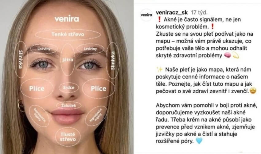 Metoda mapování pleti podle východní medicíny