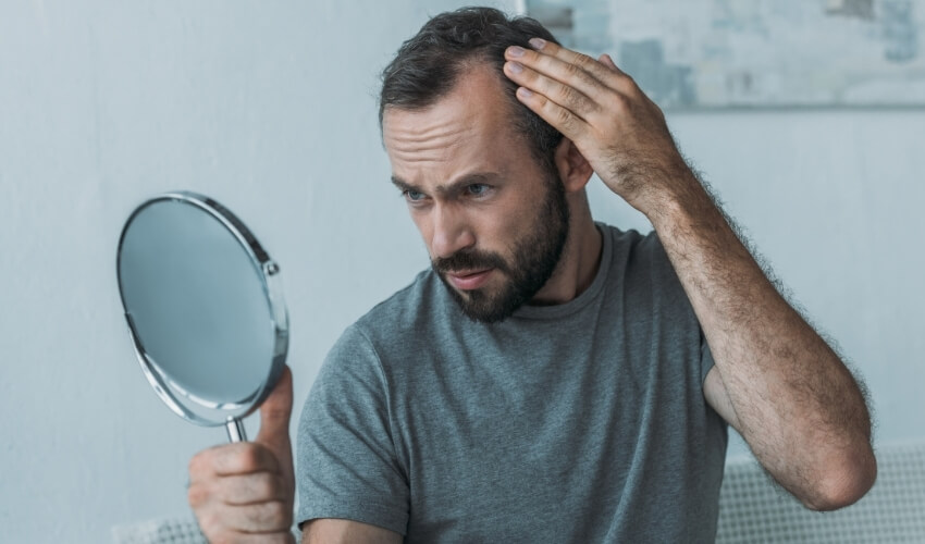 Vypadávání vlasů u mužů jako jeden z projevů nízkého testosteronu