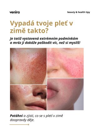 Mráz pleti rozhodně neprospívá tak, jak si spousta lidí myslí ❄️ V zimě se pleť hůř regeneruje, ztrácí hydrataci, je...