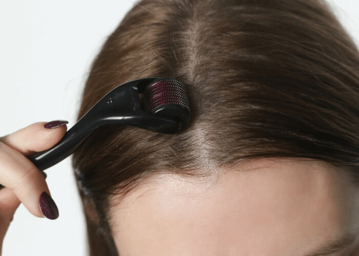 Derma roller - budú vďaka nemu rásť vlasy rýchlejšie?