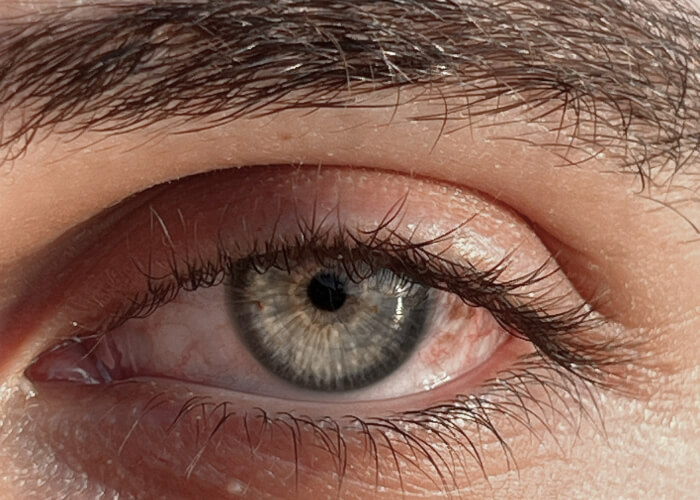 Ako na bolesť očí? Či už vás trápi starnutie očí alebo nadbytok modrého svetla, máme riešenie!