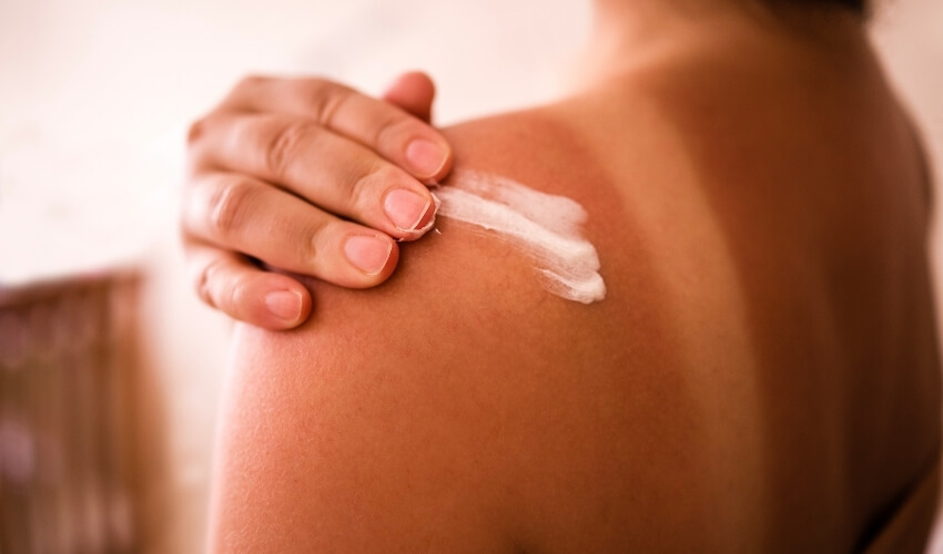 Nanášanie opaľovacieho krému s SPF na pokožku